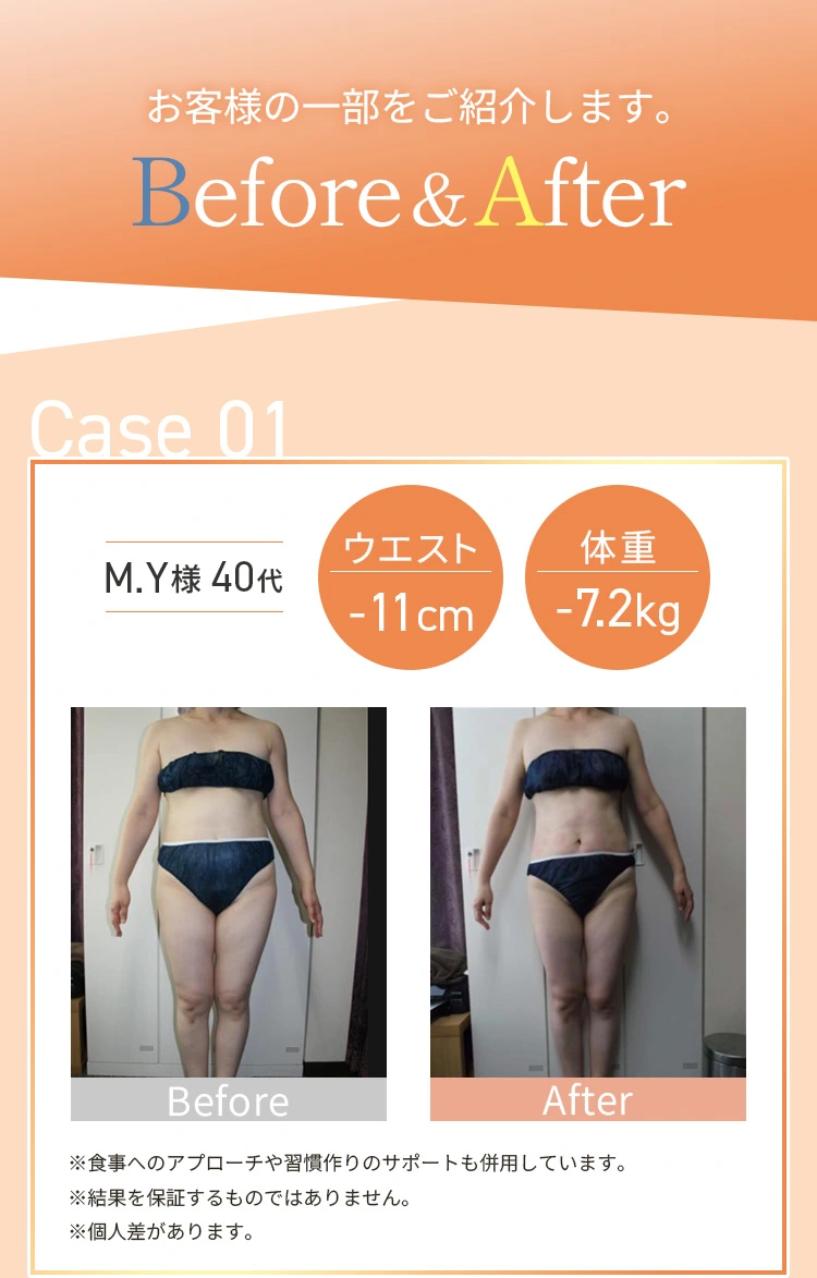 お客様の一部をご紹介します。Before&After/Case01
