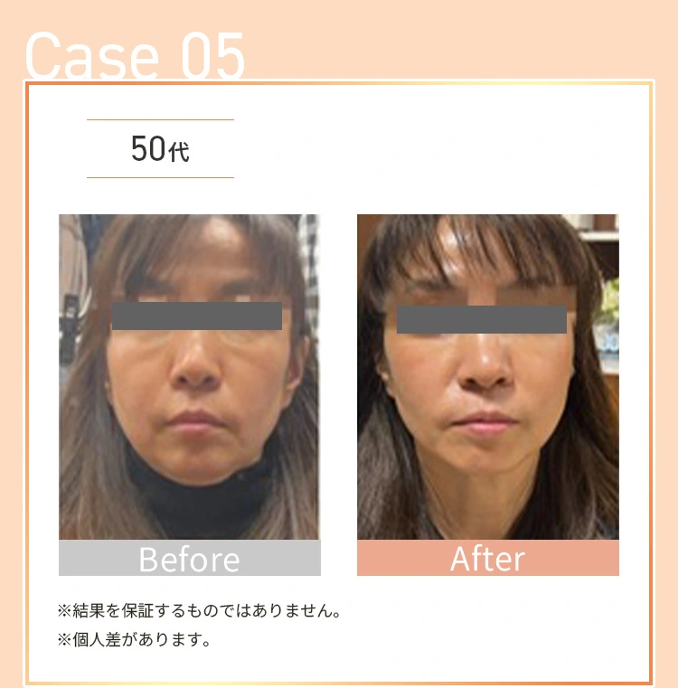 お客様の一部をご紹介します。Before&After/Case05