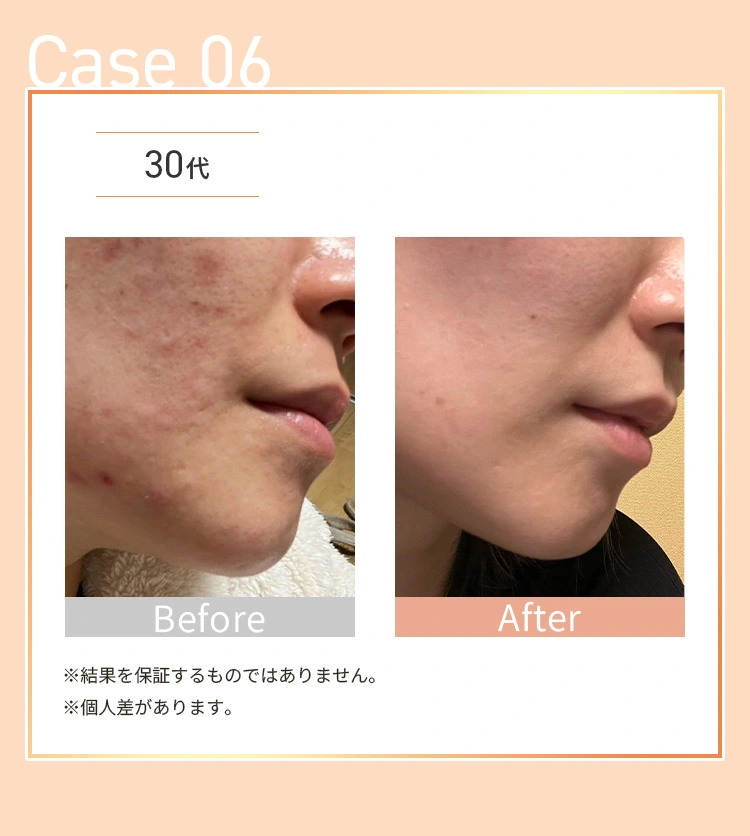 お客様の一部をご紹介します。Before&After/Case06